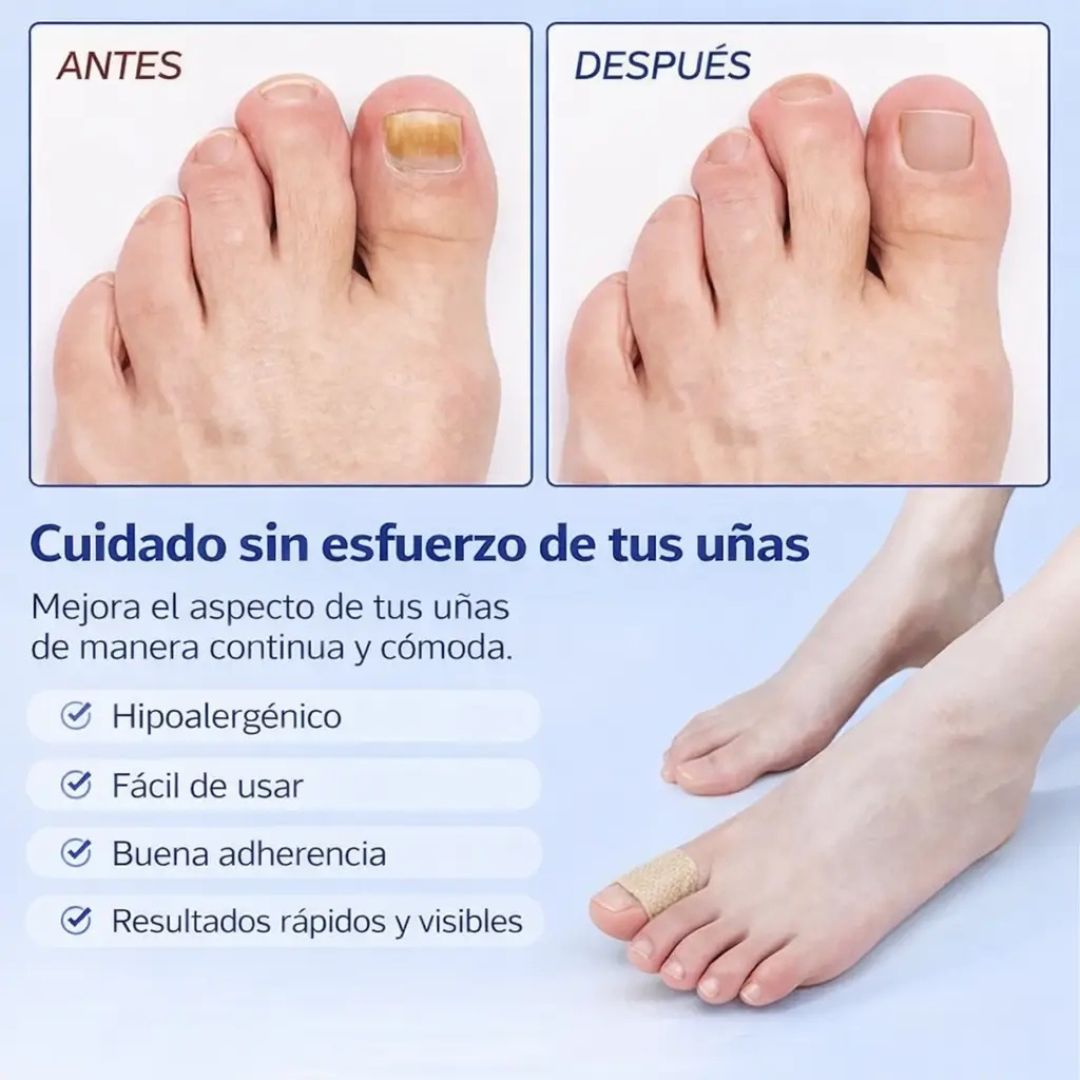 ClearNail Patch — Recupera el aspecto natural de tus uñas
